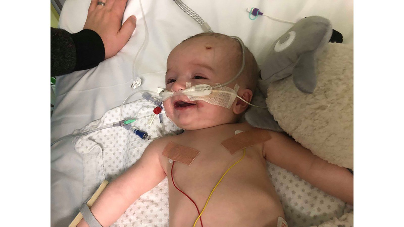 A baby woke up from a coma and smiled at his dad. Now his family is raising money to save his life